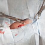 Dog spay surgery in progress.